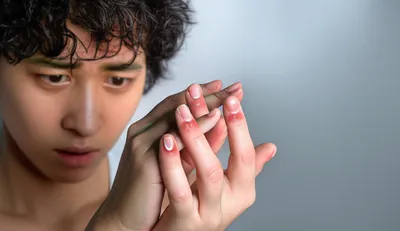 Illustration frets - Image 1