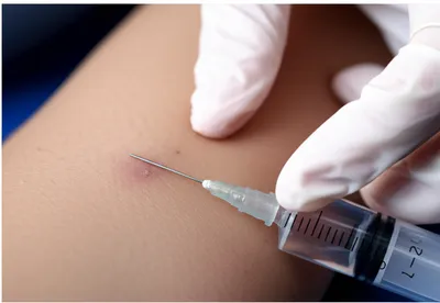 Illustration syringes - Image 1