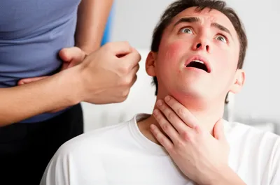 Illustration choking - Image 1