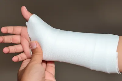 Illustration casts - Image 1