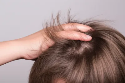 Illustration rumple - Image 1