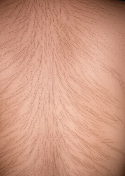 Illustration welts - Image 1