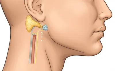 Illustration parotid