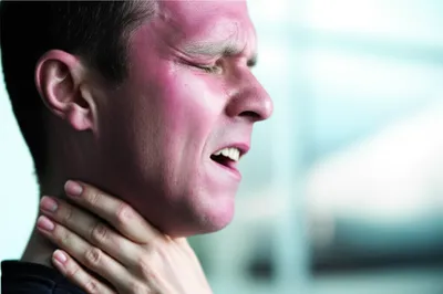 Illustration chinked - Image 1