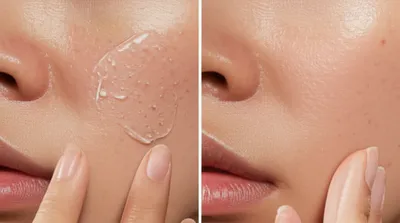 Illustration peels - Image 1