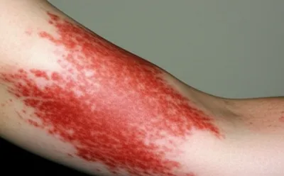 Illustration wildfire - Image 1