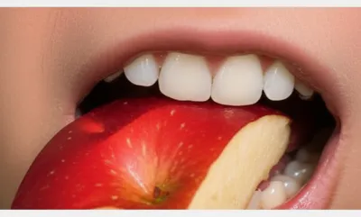 Illustration chews - Image 1