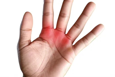 Illustration case - Image 1