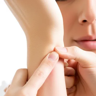 Illustration pinches - Image 1