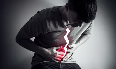 Illustration keel - Image 1