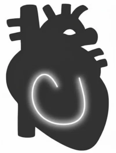 Illustration reentrant - Image 1