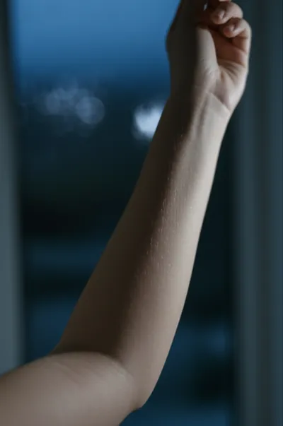 Illustration goosebumps - Image 1