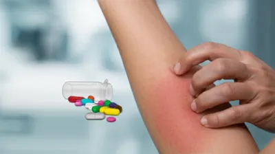 Illustration irritants