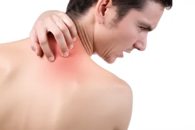 Illustration itch - Image 1