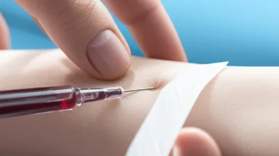 Illustration phlebotomy