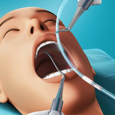 Illustration intubate - Image 1