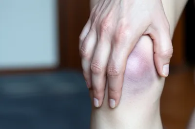 Illustration soreness - Image 1