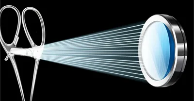 Illustration dioptres - Image 1