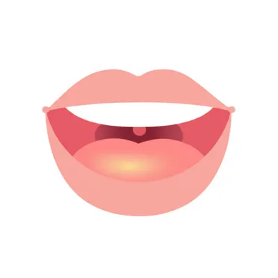 Illustration coronal - Image 1