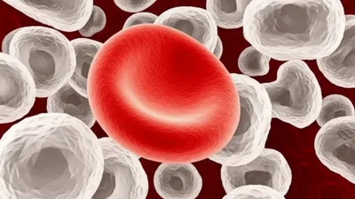 Illustration leukemia - Image 1