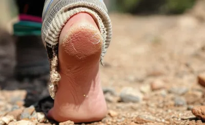 Illustration galled - Image 1