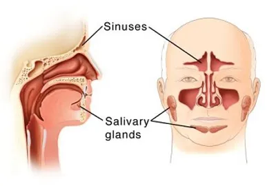 Illustration gland - Image 2