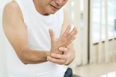 Illustration spasm - Image 2