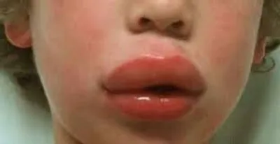 Illustration puff - Image 4