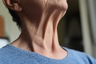 Illustration wattle - Image 1