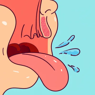 Illustration occlusion - Image 1