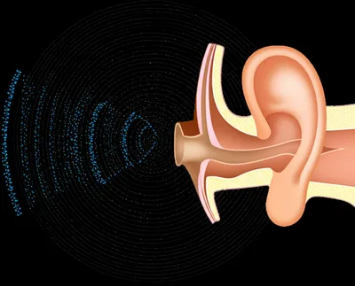 Illustration sound - Image 1