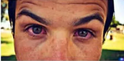 Illustration bloodshot - Image 2