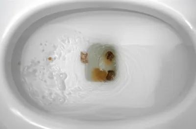 Illustration excreta