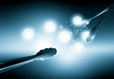 Illustration tongs - Image 1