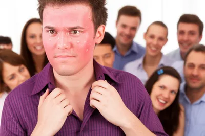 Illustration burnt - Image 1