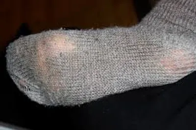 Illustration threadbare - Image 2