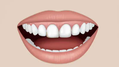 Illustration cuspid - Image 1