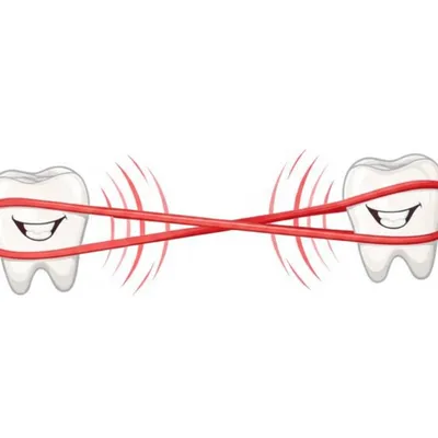 Illustration twanging - Image 1