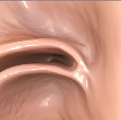 Illustration turbinal