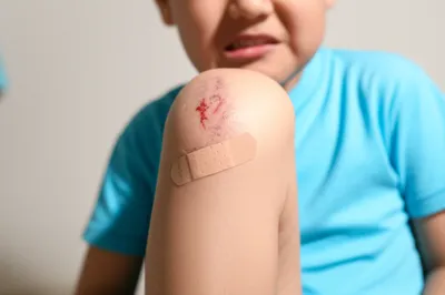 Illustration injures - Image 1