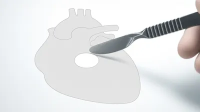 Illustration excised - Image 1