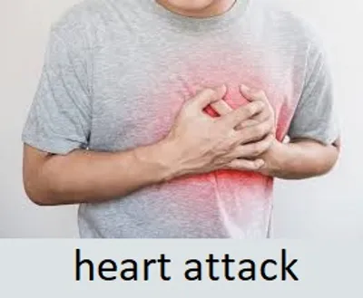 Illustration attack - Image 2