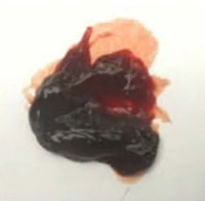 Illustration clot - Image 2