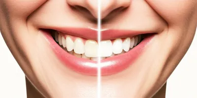 Illustration denture - Image 1