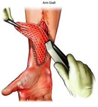 Illustration graft - Image 3