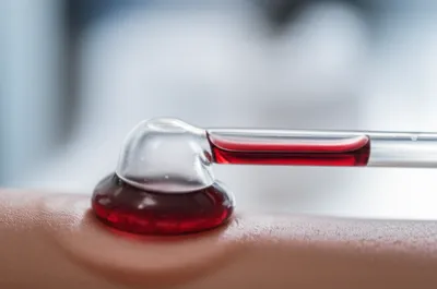 Illustration leaches - Image 1