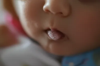 Illustration spittle - Image 1