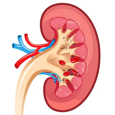 Illustration clearance - Image 1