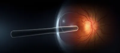 Illustration rods - Image 1