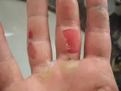 Hình ảnh minh họa raw - Ảnh 2